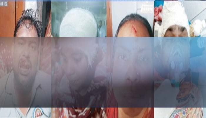 রাস্তার জায়গা দখল করে প্রাচীর নির্মাণ নিয়ে হামলা, একই পরিবারের ৫ জন আহত